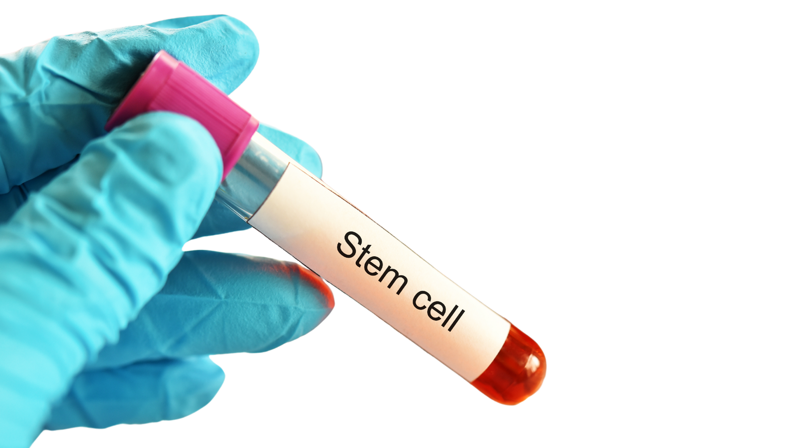 Stem Cells for Anti Ageing